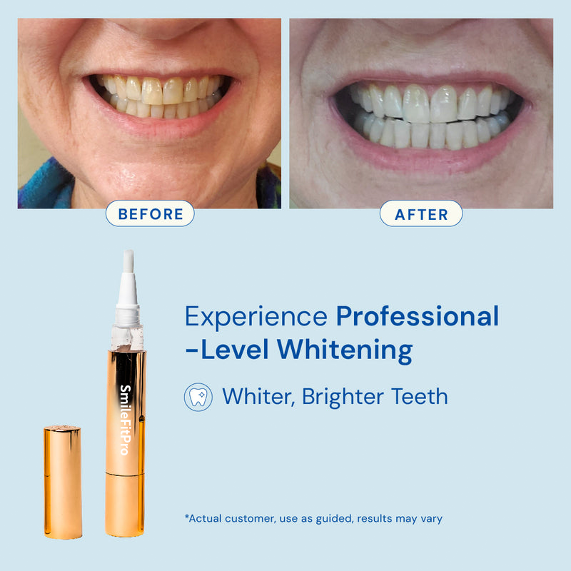 SmileFitPro™ Teeth Whitening Serum
