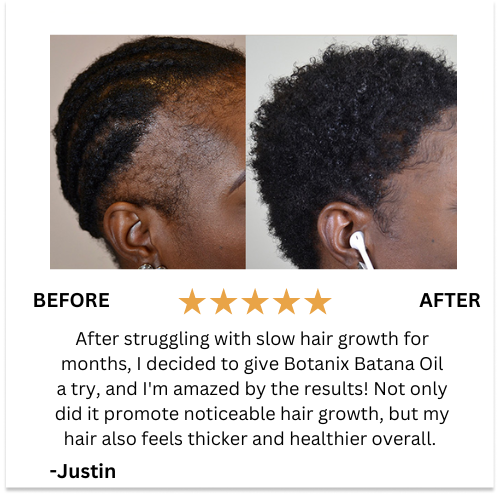 BOTANIX™ Batana Natural Hair Growth Oil