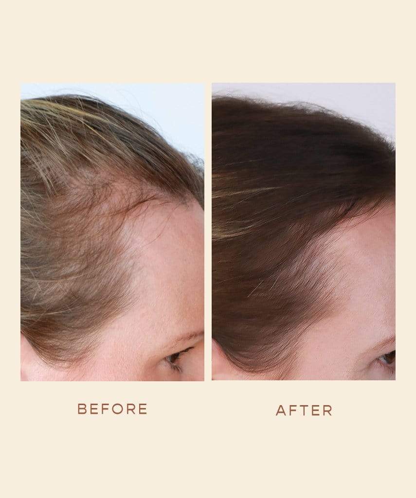 PURE BEAUTY - The Ultimate Hair Growth Oil