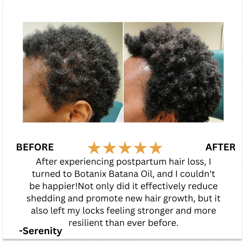 BOTANIX™ Batana Natural Hair Growth Oil