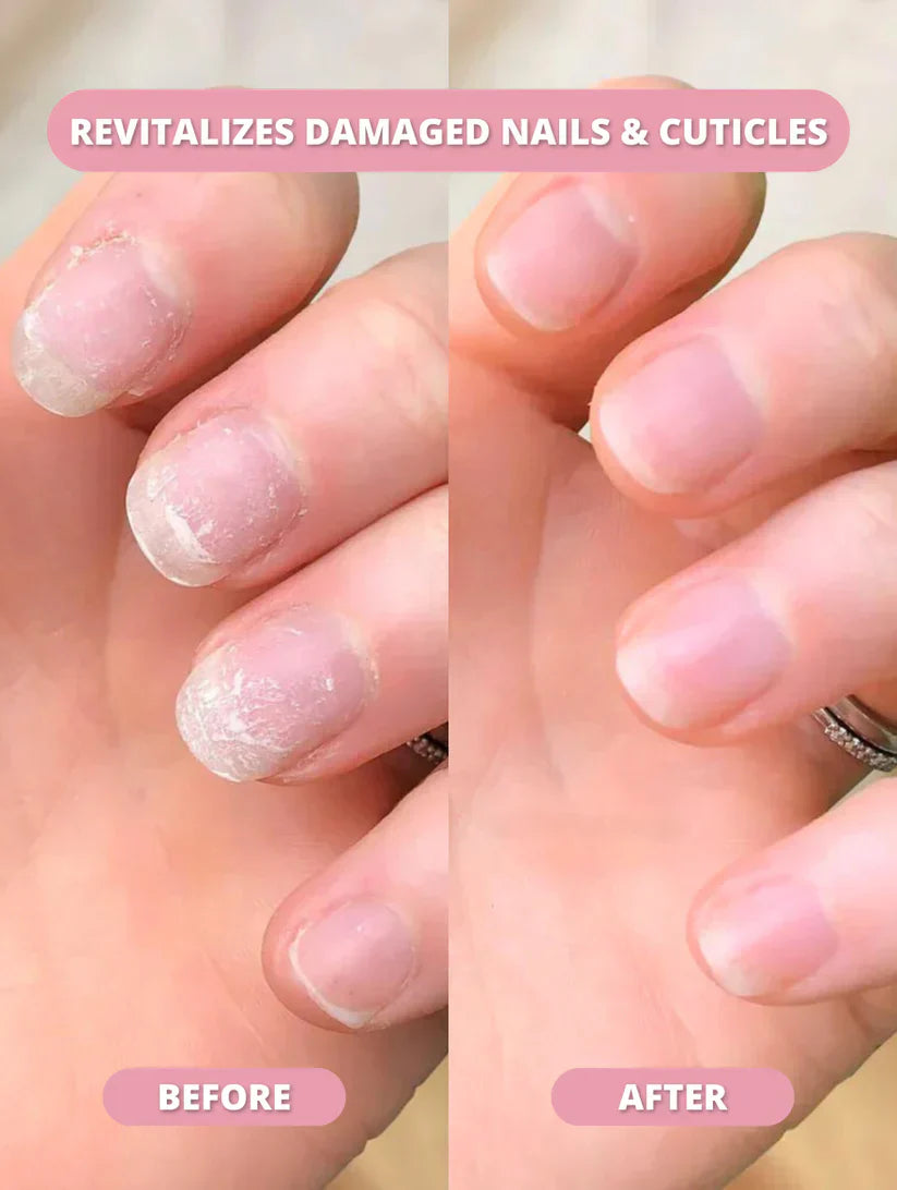 Nailixir™ Nail Growth Pen (75% OFF TODAY ONLY)