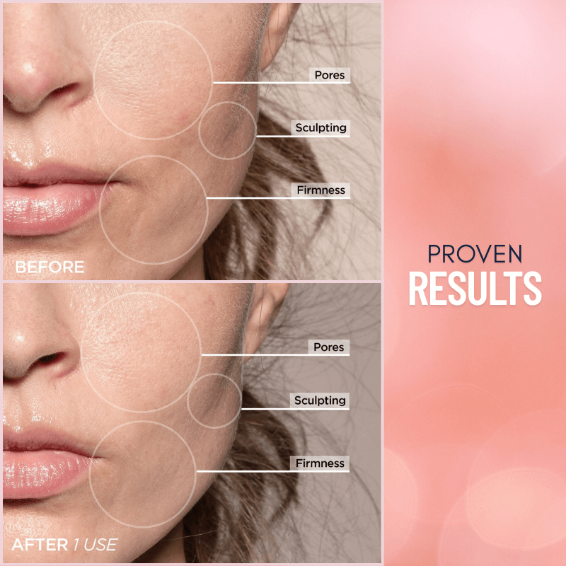 WrinkleAway Pro™ 7-in-1 LED Face Sculptor