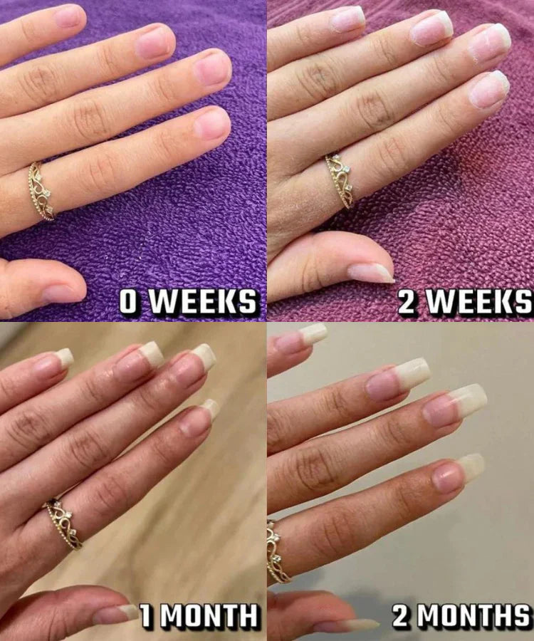 Nailixir™ Nail Growth Pen (75% OFF TODAY ONLY)