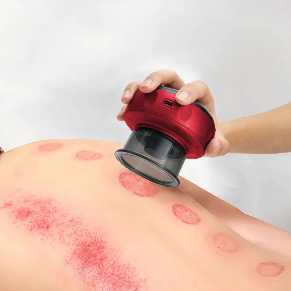 WonderCup™- Cupping Massager